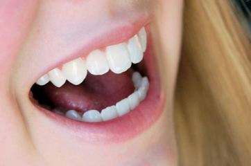 This photo of a young girl's beautiful and healthy smile - an example of good oral care (and genes) was taken by photographer Julia Freeman-Woolpert of Concord, NH.